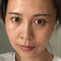 赵玉凤医生